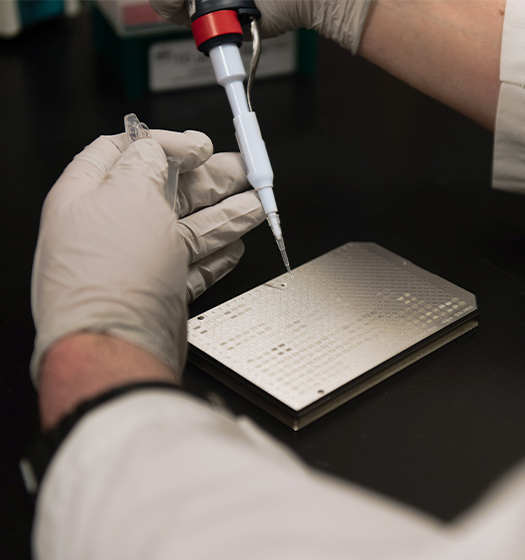 A person using a pipette to do a sample