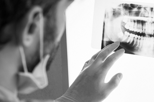 Doctor examining a mouth x-ray photo